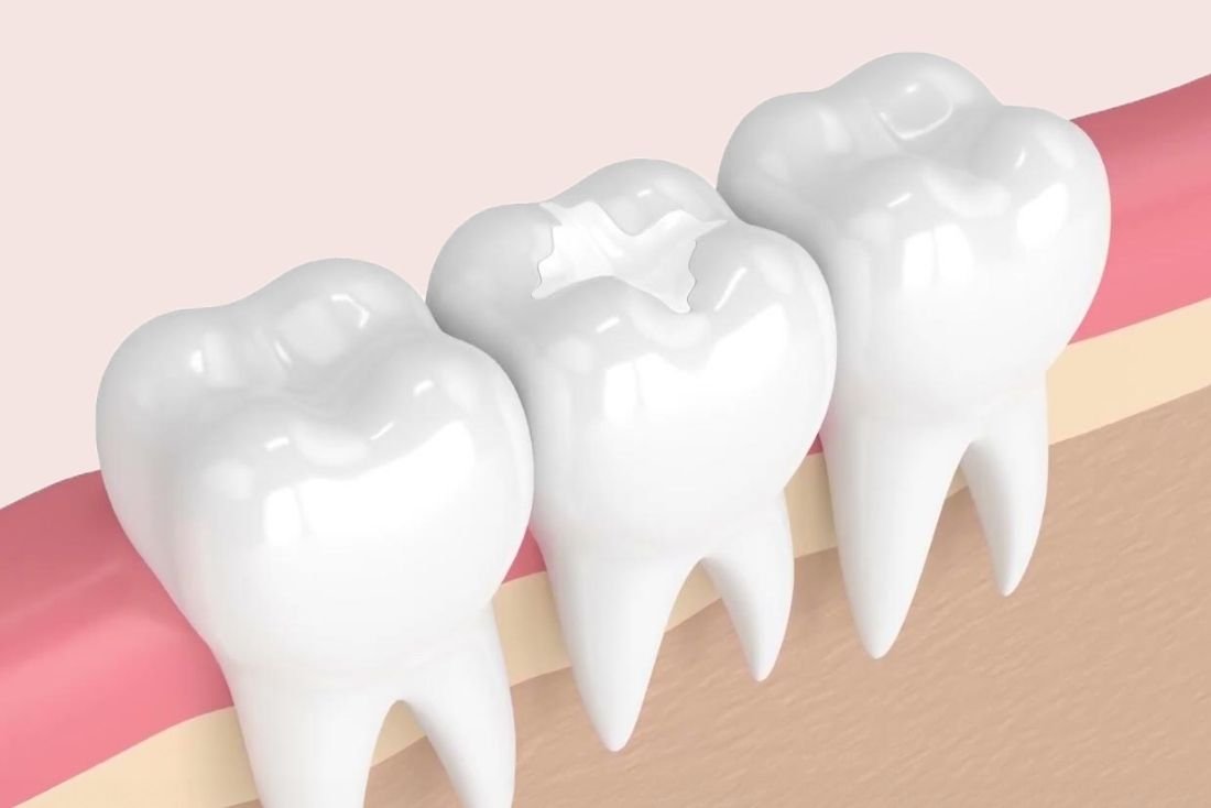 Augusta GA Dentist